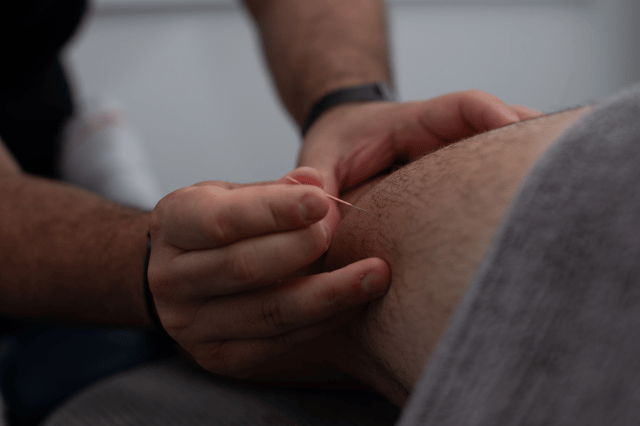 Dry needling at Gladesville Healthcare