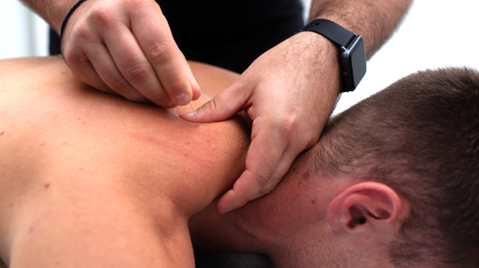 A person receives dry needling therapy on the upper back from a healthcare practitioner.
